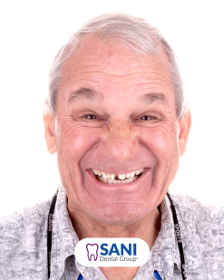 Before from Peter Hoffmann